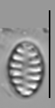 Staurosirella neopinnata LM7