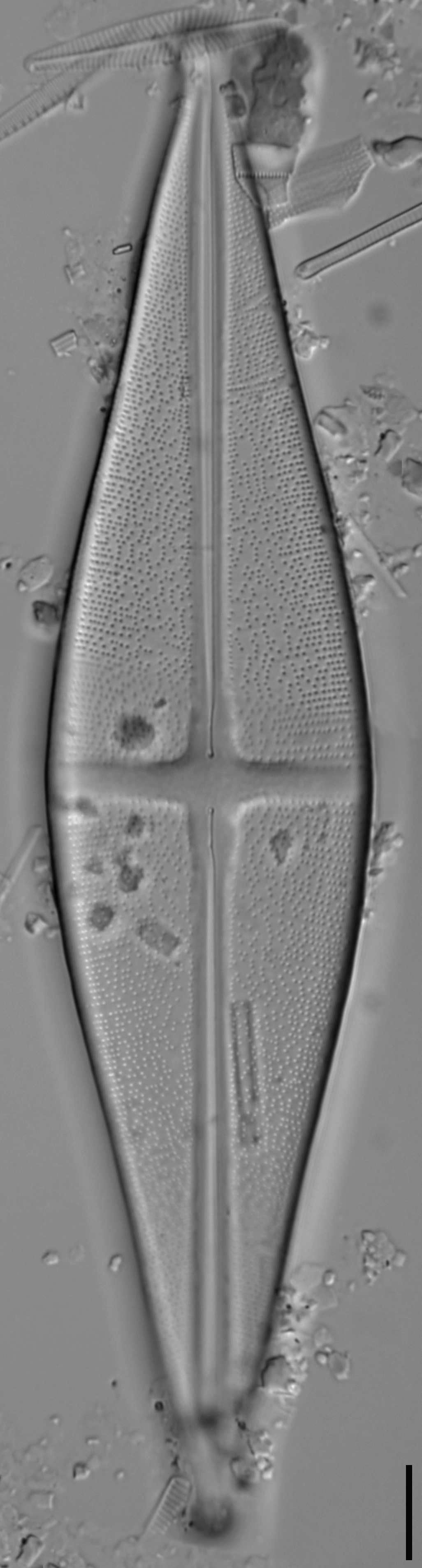 Stauroneis nobilis LM1