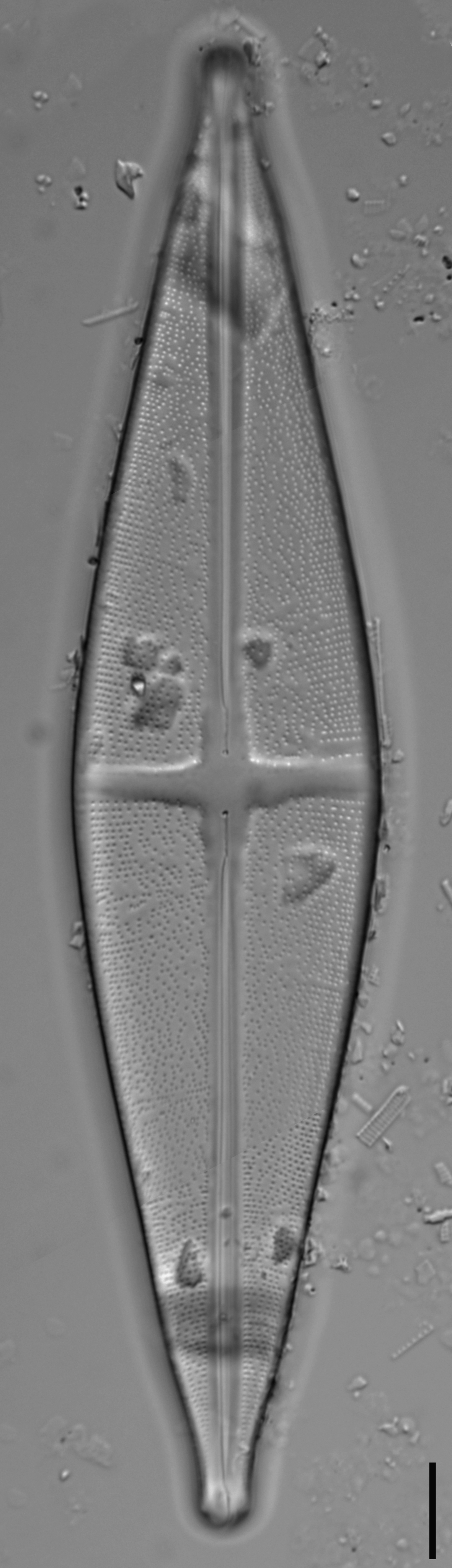 Stauroneis nobilis LM2