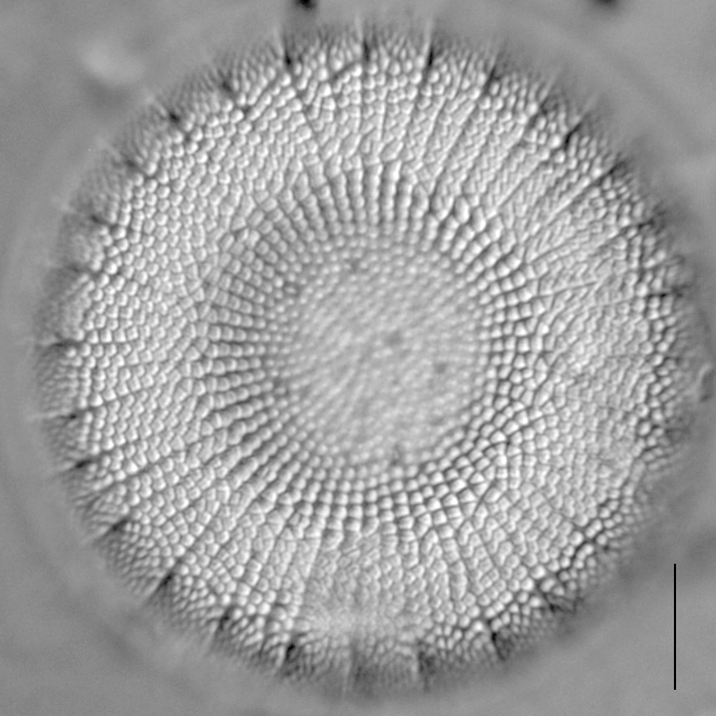 Stephanodiscus reimeri LM5