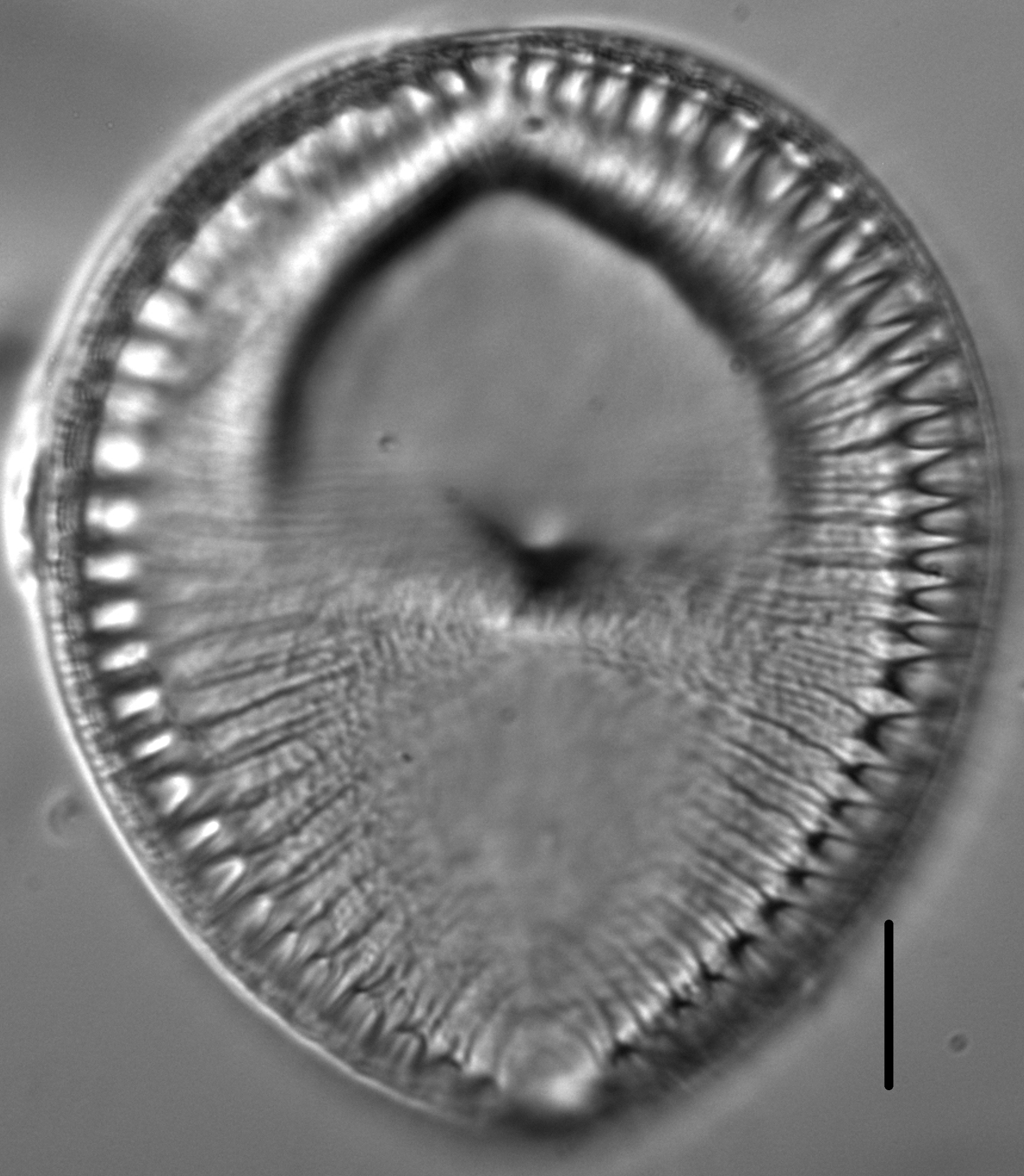 Surirella crumena LM6