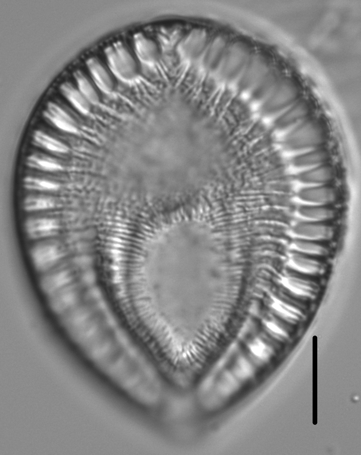 Surirella crumena LM3