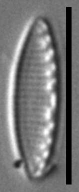 Taxa ICF22 SDAC001 100x 03042023001 Overlay008 cl