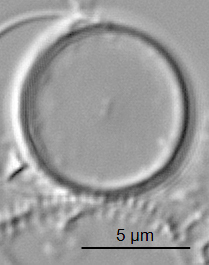 Thalassiosira minima ANSP GC59341 02