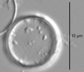 Thalassiosira minima LM3