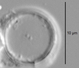 Thalassiosira minima LM5