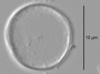 Thalassiosira minima LM6