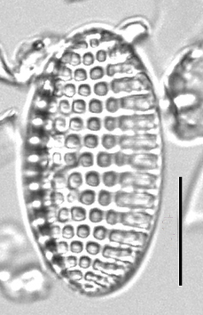 Tryblionella granulata LM5