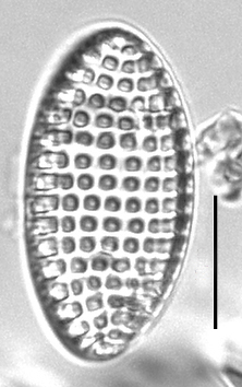 Tryblionella granulata LM4