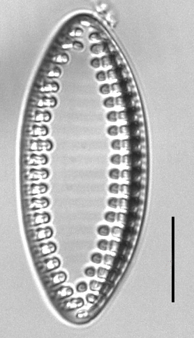 Tryblionella granulata LM2