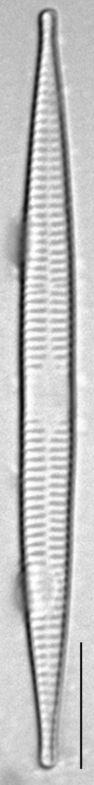 Ulnaria acus LM8