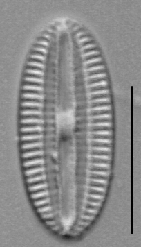 Diploneis marginestriata LM2