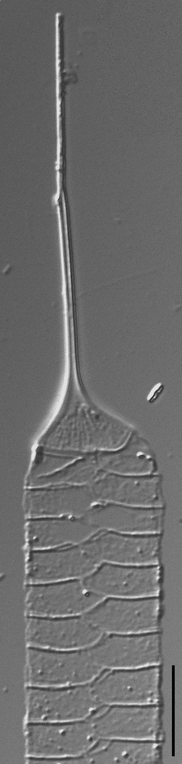 Urosolenia Eriensis Lm16