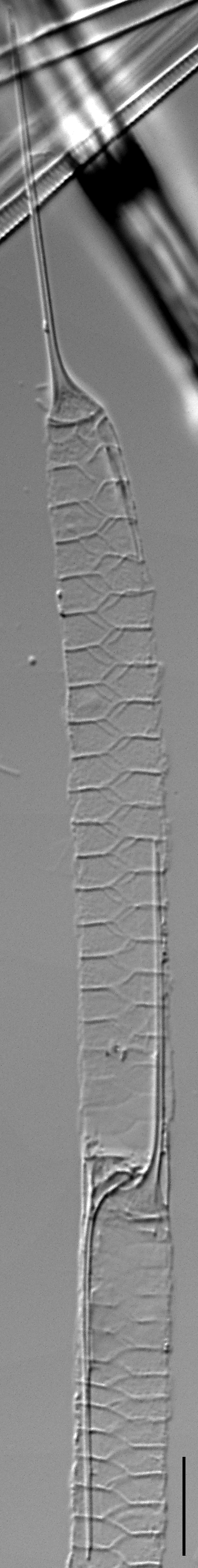 Urosolenia Eriensis Lm3C