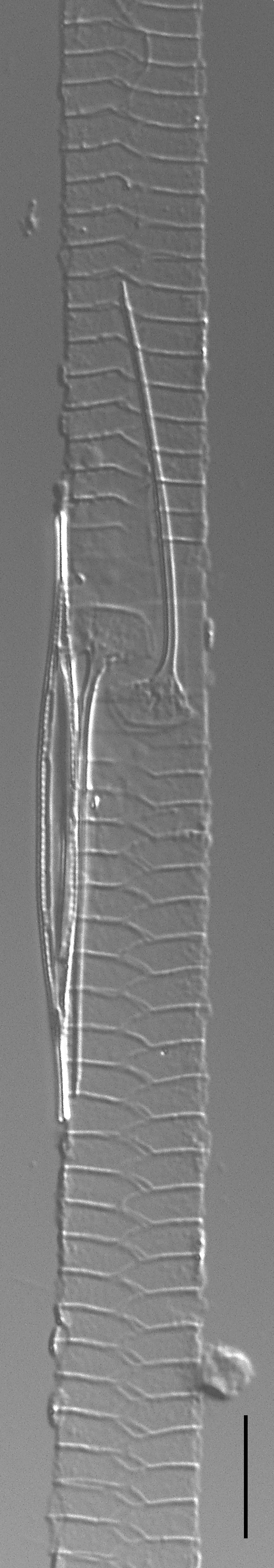 Urosolenia Eriensis Lm7