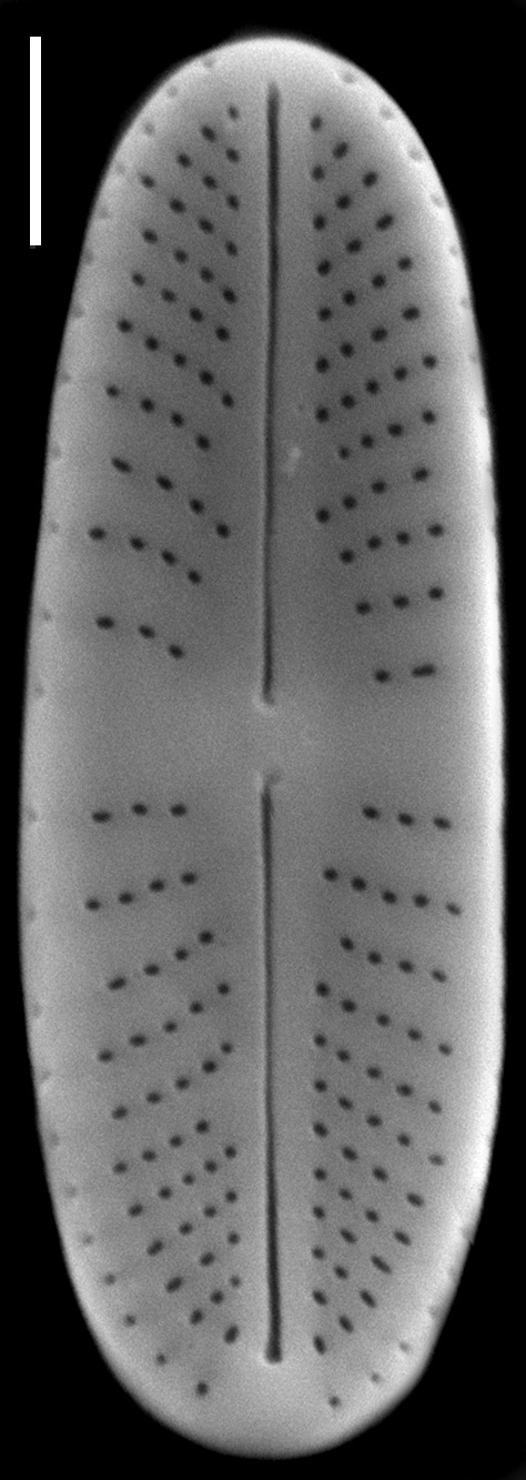 Achnanthidium atomus SEM1