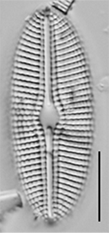 Diploneis calcilacustris LM1