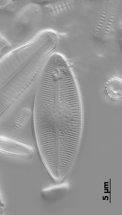 Psammothidium lacustre LM2