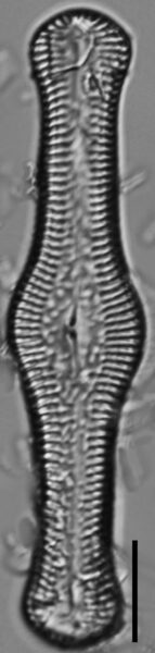 Pinnularia turgidula LM5