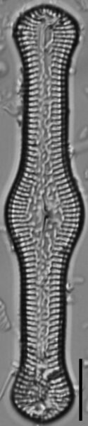 Pinnularia turgidula LM6