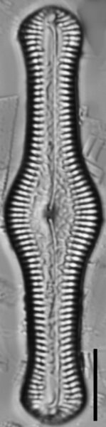 Pinnularia turgidula LM7