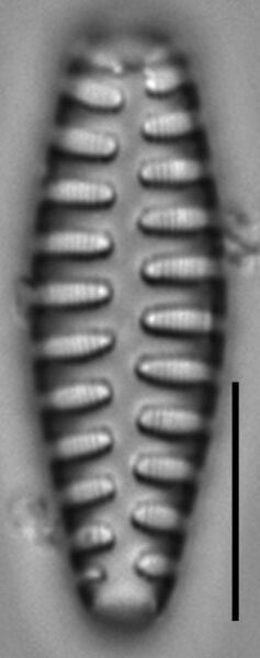 Staurosirella martyi LM5