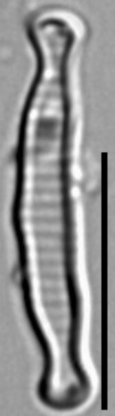 Eunotia microcephala LM5