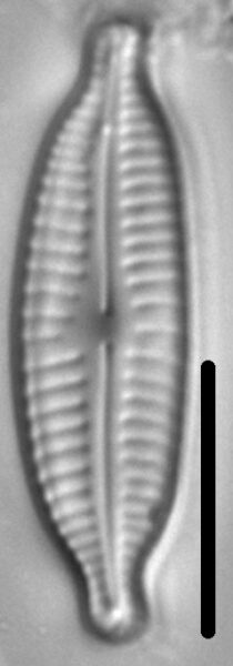 Cymbopleura amphicephala LM4