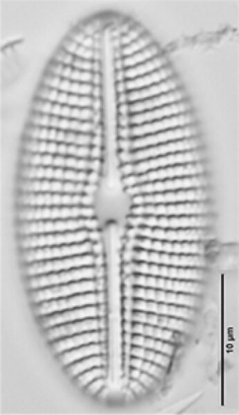 Diploneis calcilacustris LM3