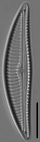 Encyonema silesiacum var elegans LM2
