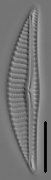 Encyonema silesiacum var elegans LM6