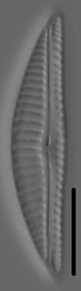 Encyonema silesiacum var elegans LM7