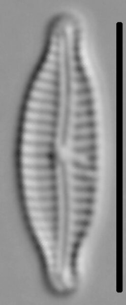 Encyonemopsis Microcephala 005