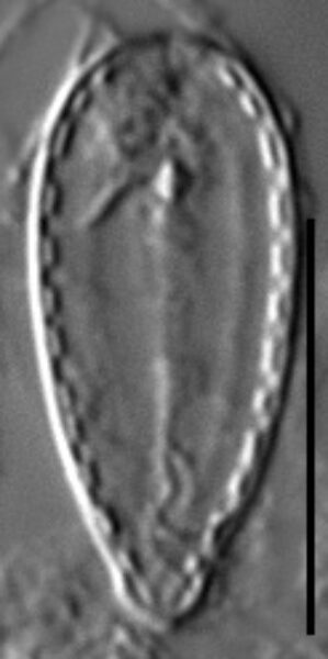 Surirella stalagma LM7