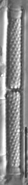 Aulacoseria granulata var. angustissima LM6