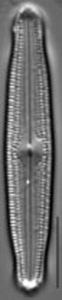 Neidiopsis hamiltonii LM1