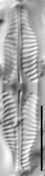 Pinnularia pluvianiformis LM1