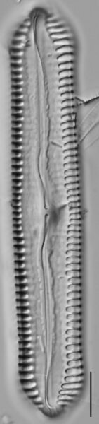 Pinnularia cuneicephala LM7