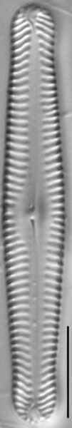 Pinnularia gibbiformis ANSP 00404 01