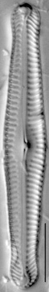 Pinnularia gibbiformis ANSP 00404 02