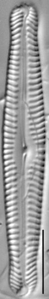Pinnularia gibbiformis ANSP 00404 05