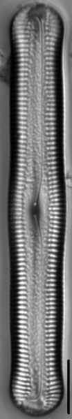 Pinnularia acrosphaeria LM7