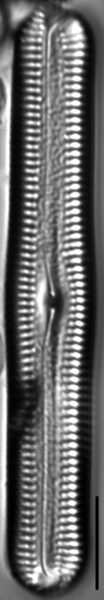 Pinnularia acrosphaeria LM3