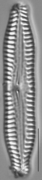 Pinnularia nodosa LM3