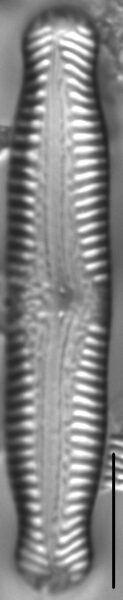 Pinnularia nodosa LM1