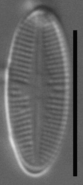 Psammothidium sacculum LM6