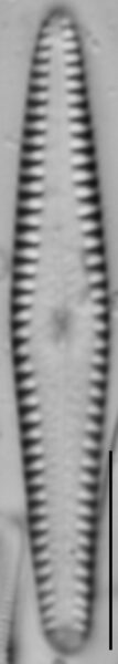 Gomphonema louisiananum LM3