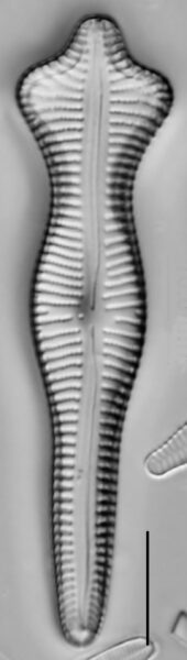Gomphonema Acuminatum 002