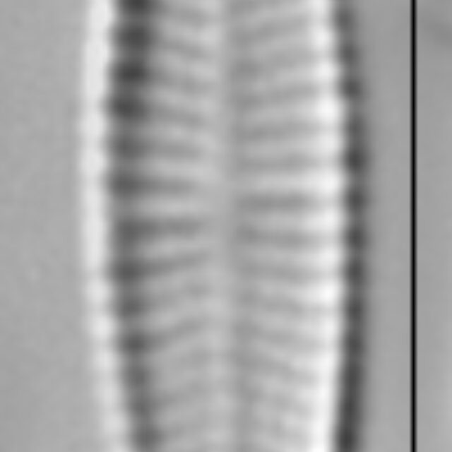 Achnanthidium minutissimum LM2