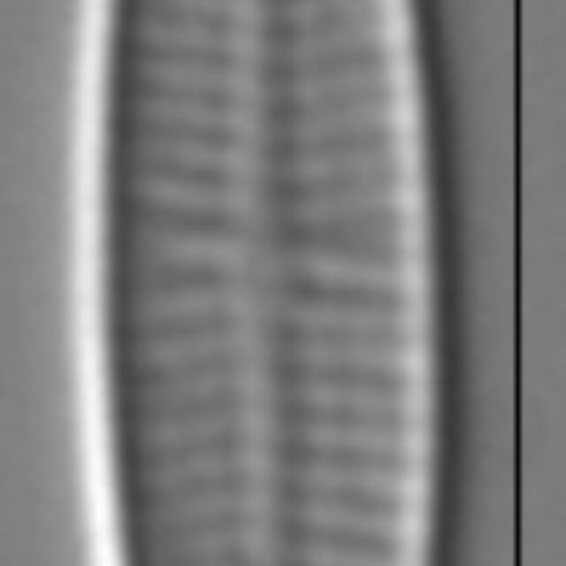 Achnanthidium minutissimum LM4